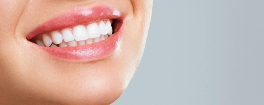 Achieving the Perfect Hollywood Smile