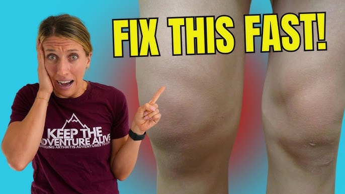 Can a Knee Cap Help With Knee Pain and Swelling?