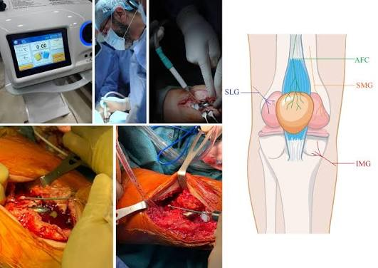 Blood Loss and Pain Management in Total Knee Replacement: What Research Shows