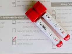 How Are Oral STDs Tested? Throat Swabs, Blood Tests and What to Expect
